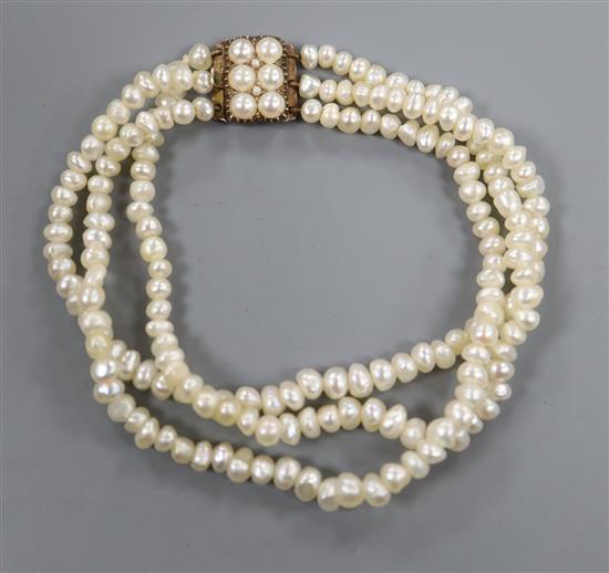 A triple strand baroque cultured pearl bracelet with yellow metal and cultured pearl clasp, 17cm.